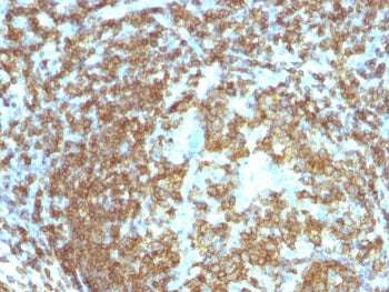CD45RA Antibody (Leukocyte marker)