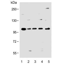 PCDH20 Antibody / Protocadherin 20