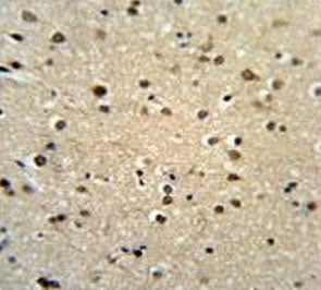 Teashirt homolog 2 Antibody / TSHZ2