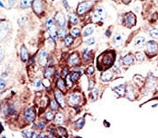AXL Antibody