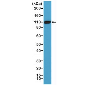 Western blot testing of human LNCaP cell lysate with recombinant PSMA antibody at 1:1000. Predicted