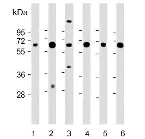 PCK1 Antibody / PEPCK1 / PEPC