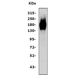 EGF Receptor / EGFR Antibody (N-Terminal Region)