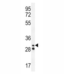 Neutrophil elastase antibody western blot analysis in A2058 lysate. Predicted molecular weight: 29-3