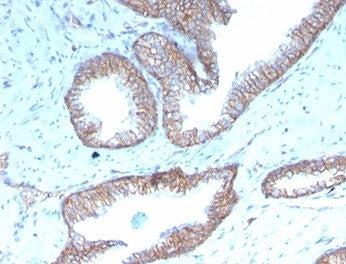 IHC staining of FFPE human prostate tissue with recombinant SHBG antibody (clone rSHBG/245). HIER: b