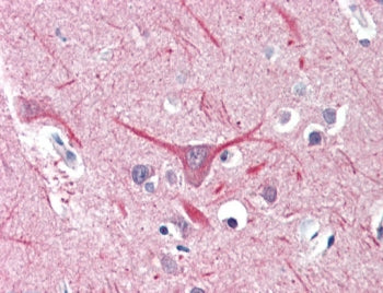 IHC testing of FFPE human brain (cortex) tissue with UBR2 antibody at 5ug/ml. HIER: steamed antigen