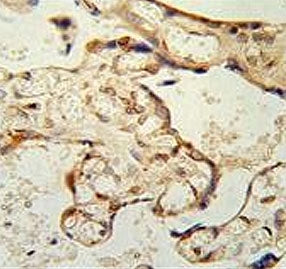 Paraoxonase 2 Antibody / PON2