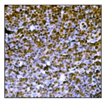 Protein PML Antibody