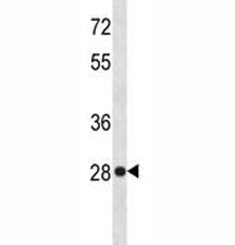 HMGB1 Antibody