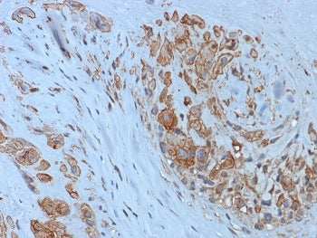 IHC staining of FFPE human placental tissue with HLA-G antibody (clone HLAG/8393R). HIER: boil tissu