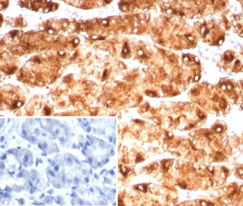 Lewis Y Antibody