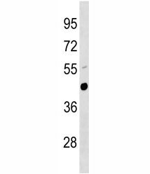 Urokinase Antibody (UPA, Plau)