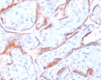PAPP-A Antibody / Pappalysin-1