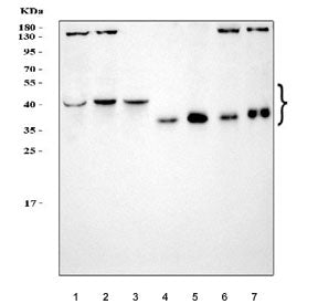 Western blot testing of 1) human HCCT, 2) human MOLT4, 3) human Jurkat, 4) rat thymus, 5) mouse thym