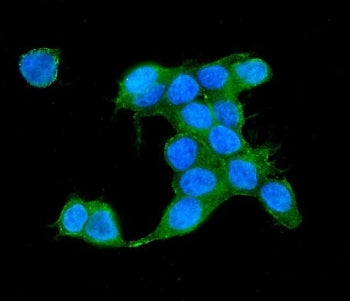 IQGAP2 Antibody
