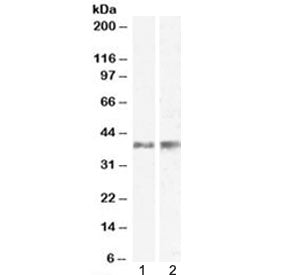 Il12b Antibody