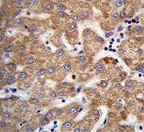 ANKRD58 Antibody / SOWAHD