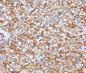 SPTBN2 Antibody / Spectrin beta III