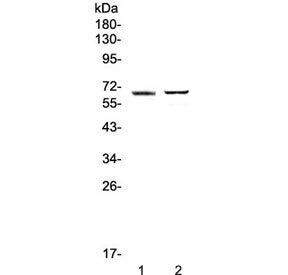 RUNX1T1 Antibody
