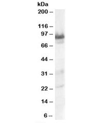 TRAK1 Antibody