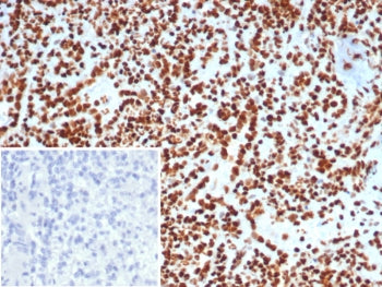 Ku80 Antibody / XRCC5