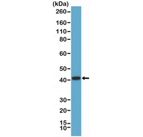 Recombinant AMACR Antibody / Alpha-methylacyl-CoA racemase