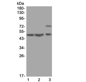 Western blot testing of 1) human U-2 OS, 2) human MCF7 and 3) rat kidney lysate with AP2M1 antibody