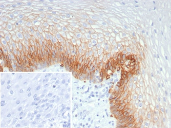 IHC staining of FFPE human esophagus tissue with SLC2A1 antibody (clone GLUT1/7308). Inset: PBS used