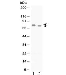 Western blot testing of 1) rat ovary and 2) human SKOV lysate with PLZF antibody. Predicted molecula