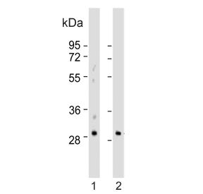 Embryonic polyadenylate-binding protein 2 Antibody / PABPN1L