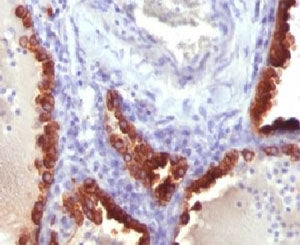 KRT7 Antibody / Cytokeratin 7