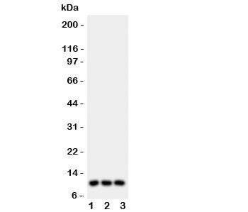 CCL1 Antibody (I-309)