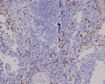 CD8A Antibody