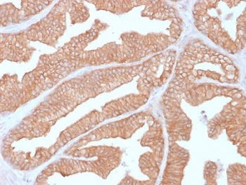 Calcineurin Antibody / PPP3CA