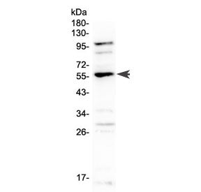 Western blot testing of rat lung tissue with EPO Receptor antibody at 0.5ug/ml. Predicted molecular