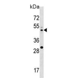 Western blot testing of human U937 cell lysate with MEK2 antibody. Expected molecular weight: 45-50