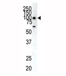 EphA1 Antibody