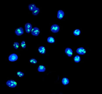 DDX21 Antibody / Nucleolar RNA helicase 2
