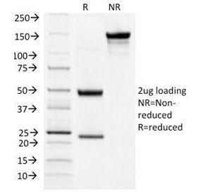 SDS-PAGE Analysis of Purified, BSA-Free TSHR Antibody (clone TSHRA/1404). Confirmation of Integrity