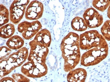 FABP1 Antibody