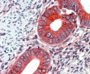 EPB41L2 Antibody