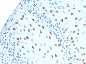 p21 Antibody / CDKN1A
