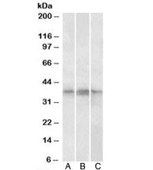 PHF11 Antibody