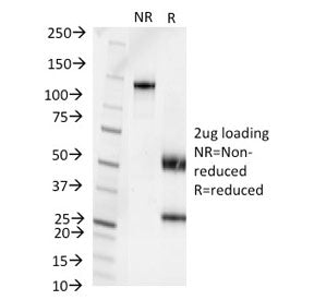 SDS-PAGE analysis of purified, BSA-free Pseudomonas aeruginosa serotype 6C antibody (clone 1200/472)