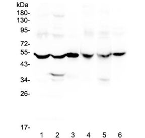 Western blot testing of rat 1) brain, 2) liver, 3) small intestine and mouse 4) brain, 5) liver and