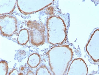 TrkB Antibody / NTRK2
