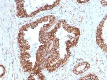 TMEPAI Antibody / PMEPA1