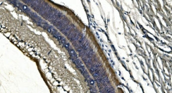 PDE6 alpha Antibody / PDE6A