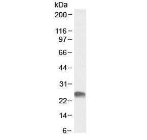 GSTA3 Antibody