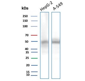 NSE Antibody / Neuron Specific Enolase